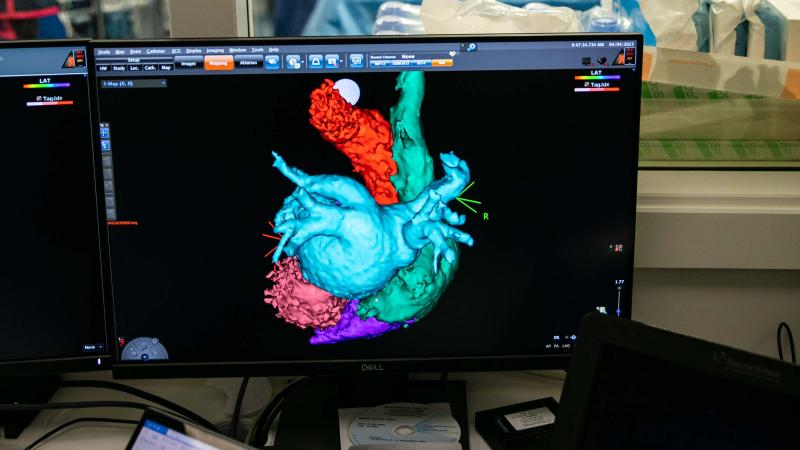 Cath Lab theatre image